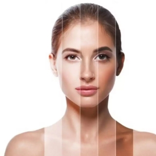 Dull Complexion Treatment in Delhi