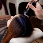 Best Scalp Treatment Clinic in Delhi