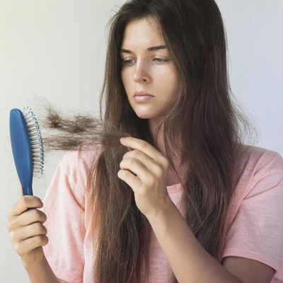 Hair Loss In Women