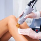 Permanent Body Hair Removal Services in Delhi