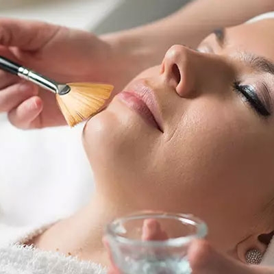 Jessner’s Peel Therapy