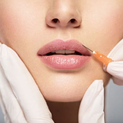 Lip Enhancement Treatment in Dakshinpuri