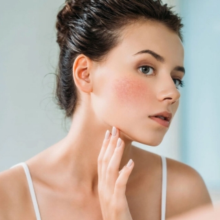 Sensitive Skin Treatment in Delhi