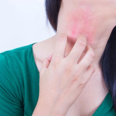 Skin Allergies Treatment in Ncr