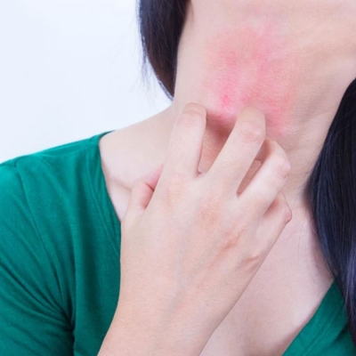 Skin Allergies Treatment in Sultanpur