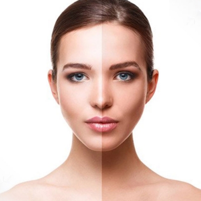 Permanent Skin Whitening Treatment in Sultanpur