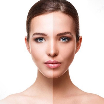 Permanent Skin Whitening Treatment in Delhi