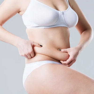 Abdominoplasty Treatment in Delhi